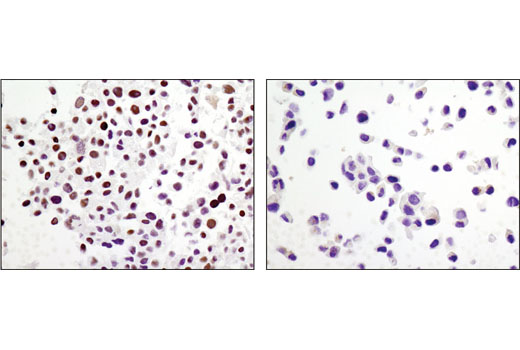 Immunohistochemistry Image 2: ARID1A/BAF250A (D2A8U) Rabbit mAb