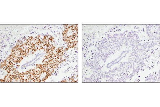 Immunohistochemistry Image 3: ARID1A/BAF250A (D2A8U) Rabbit mAb