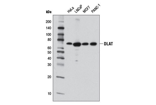 Western Blotting Image 1: DLAT (4A4-B6-C10) Mouse mAb
