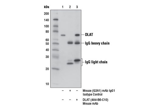 Immunoprecipitation Image 1: DLAT (4A4-B6-C10) Mouse mAb