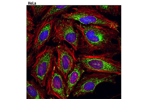 Immunofluorescence Image 1: DLAT (4A4-B6-C10) Mouse mAb