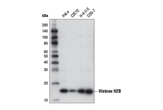 Western Blotting Image 1: Histone H2B (D2H6) Rabbit mAb