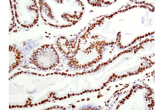 Immunohistochemistry Image 1: Histone H2B (D2H6) Rabbit mAb