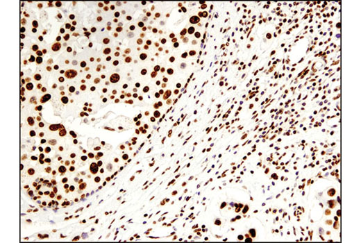 Immunohistochemistry Image 2: Histone H2B (D2H6) Rabbit mAb