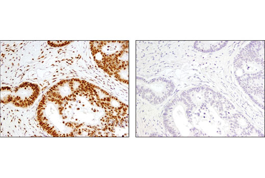 Immunohistochemistry Image 3: Histone H2B (D2H6) Rabbit mAb