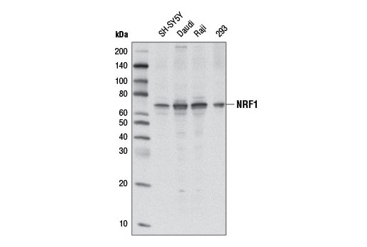 Western Blotting Image 1: NRF1 Antibody
