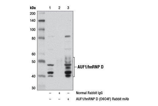 Immunoprecipitation Image 1: AUF1/hnRNP D (D6O4F) Rabbit mAb