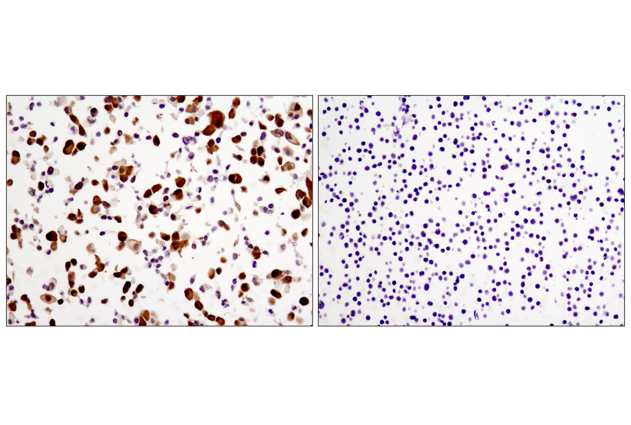 Immunohistochemistry Image 3: YAP (1A12) Mouse mAb