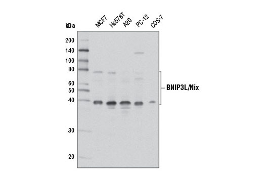  Image 12: Mitophagy Antibody Sampler Kit