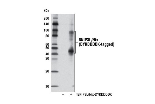  Image 19: Mitophagy Antibody Sampler Kit
