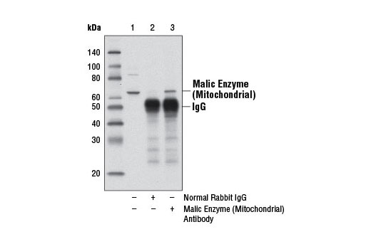 Immunoprecipitation Image 1: Malic Enzyme 2 Antibody