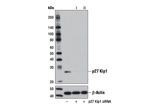  Image 1: SignalSilence® p27 Kip1 siRNA II