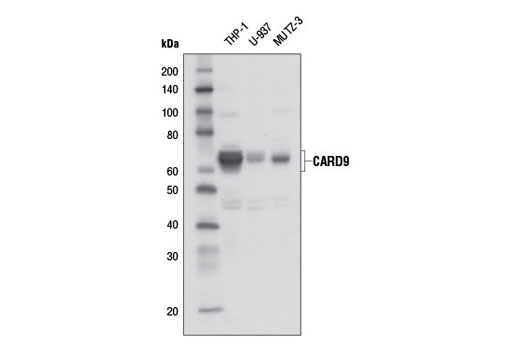 Western Blotting Image 1: CARD9 Antibody