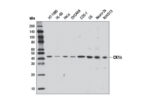 Western Blotting Image 1: CK1δ Antibody