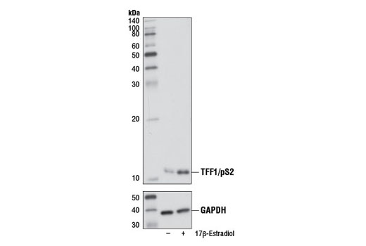 Western Blotting Image 1: TFF1/pS2 Antibody