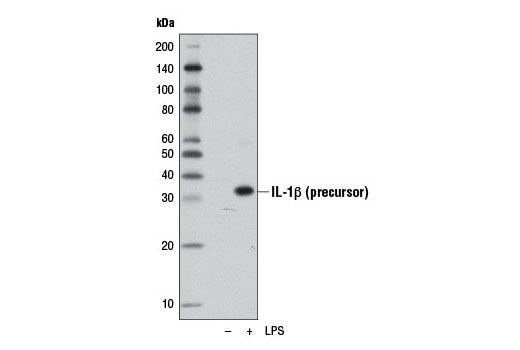 Western Blotting Image 1: IL-1β (D4T2D) Rabbit mAb (Mouse Specific)