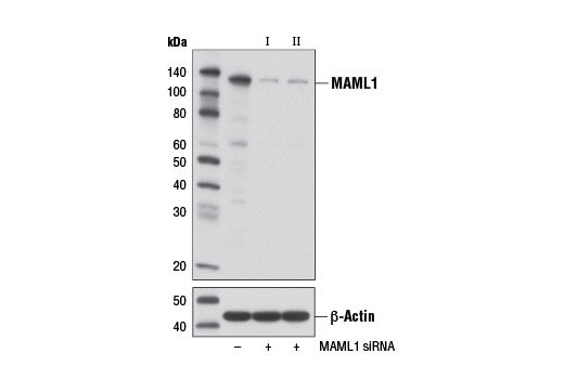  Image 1: SignalSilence® MAML1 siRNA II