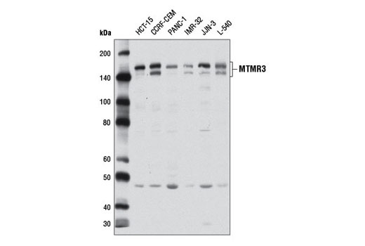 Western Blotting Image 1: MTMR3 Antibody