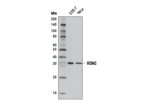 Western Blotting Image 1: VDAC (D73D12) Rabbit mAb (HRP Conjugate)