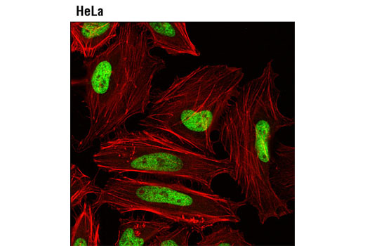 Immunofluorescence Image 1: MacroH2A1.1 (D5F6N) Rabbit mAb
