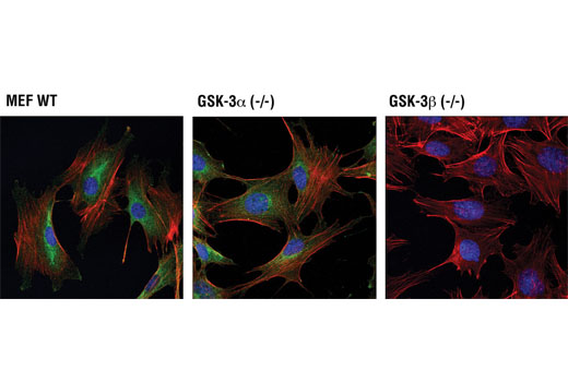 Immunofluorescence Image 1: GSK-3β (D5C5Z) XP® Rabbit mAb