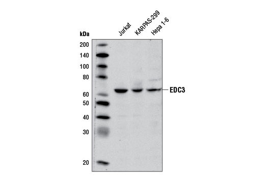 Western Blotting Image 1: EDC3 Antibody
