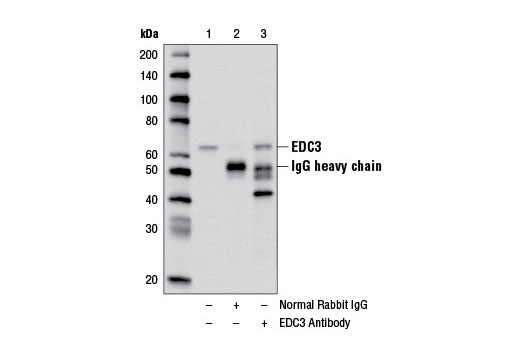 Immunoprecipitation Image 1: EDC3 Antibody