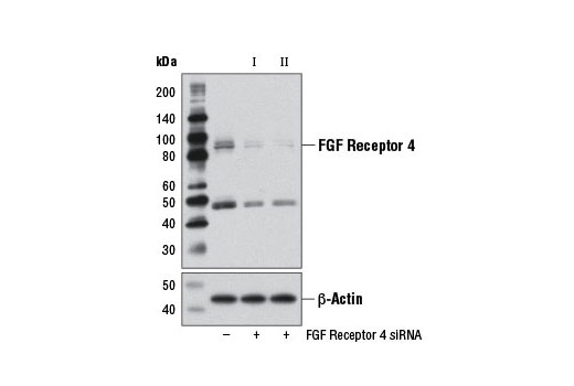  Image 1: SignalSilence® FGF Receptor 4 siRNA I