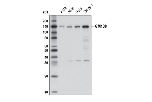  Image 1: Exosomal Marker Antibody Sampler Kit