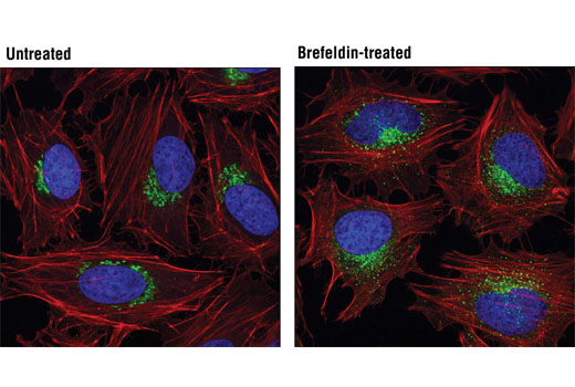 Immunofluorescence Image 1: GM130 (D6B1) XP® Rabbit mAb