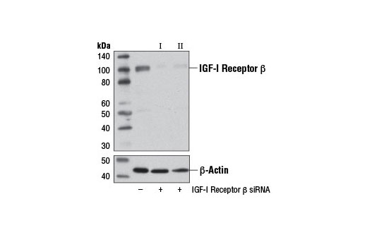  Image 1: SignalSilence® IGF-I Receptor β siRNA I (Mouse Specific)