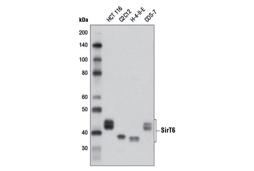  Image 1: Sirtuin Antibody Sampler Kit