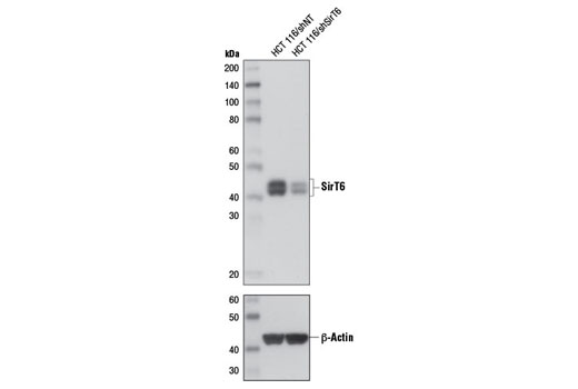  Image 9: Sirtuin Antibody Sampler Kit