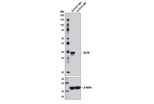  Image 14: Sirtuin Antibody Sampler Kit