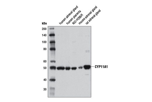 Western Blotting Image 1: CYP11A1 Antibody