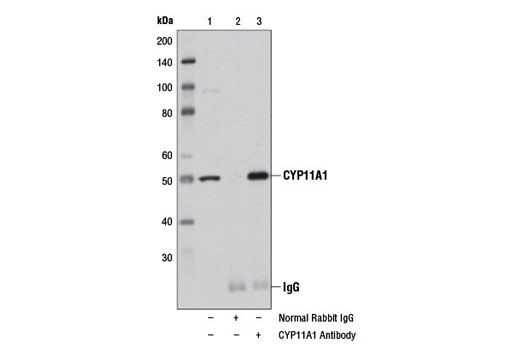 Immunoprecipitation Image 1: CYP11A1 Antibody