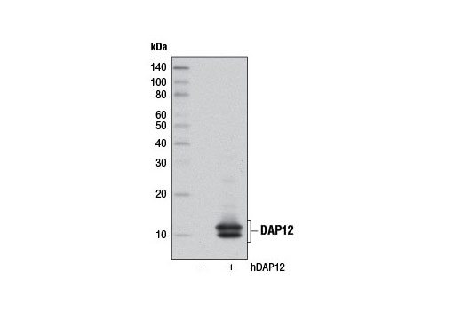  Image 13: TREM2 Signaling Pathways Antibody Sampler Kit