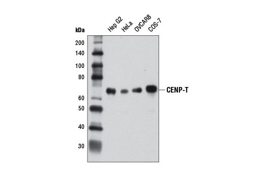 Western Blotting Image 1: CENP-T Antibody