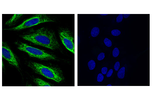 Immunofluorescence Image 1: Keratin 17 (D12E5) XP® Rabbit mAb