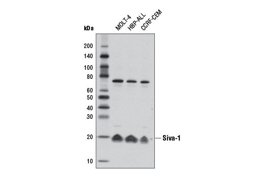 Western Blotting Image 1: Siva-1 Antibody