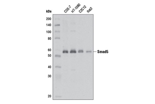  Image 1: Smad 1/5/9 Antibody Sampler Kit