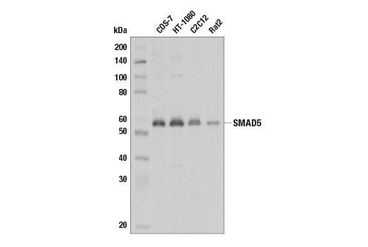  Image 3: SMAD 1/5/9 Antibody Sampler Kit