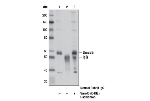  Image 8: Smad 1/5/9 Antibody Sampler Kit