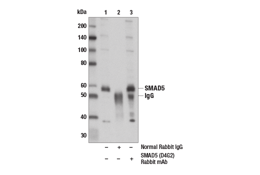 Immunoprecipitation Image 1: SMAD5 (D4G2) Rabbit mAb