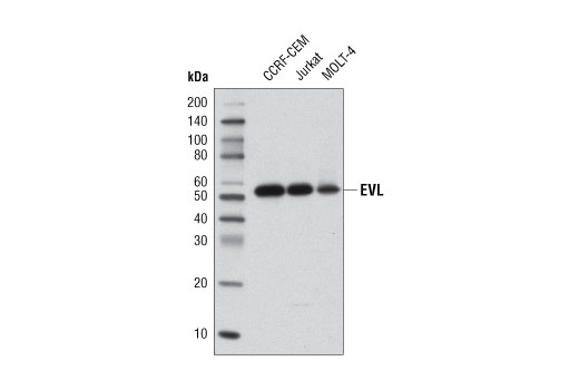 Western Blotting Image 1: EVL Antibody