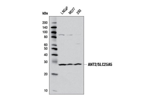 Western Blotting Image 1: ANT2/SLC25A5 Antibody