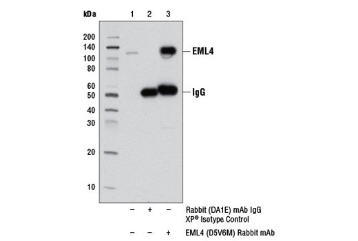 Immunoprecipitation Image 1: EML4 (D5V6M) Rabbit mAb