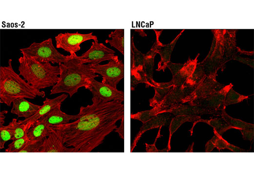 Immunofluorescence Image 1: RUNX2 (D1L7F) Rabbit mAb