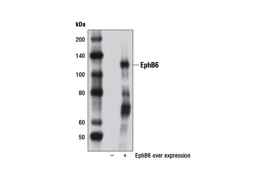 Western Blotting Image 1: EphB6 Antibody