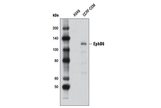 Western Blotting Image 2: EphB6 Antibody